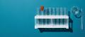 A rack of empty test tubes with one orange-capped tube, a glass beaker and a pipette on deep teal paper, representing the lab analysis the Crown needs to prove a controlled substance