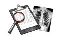 Etching of a magnifying glass on a clipboard of hospital chart forms beside a chest X-ray, on white paper